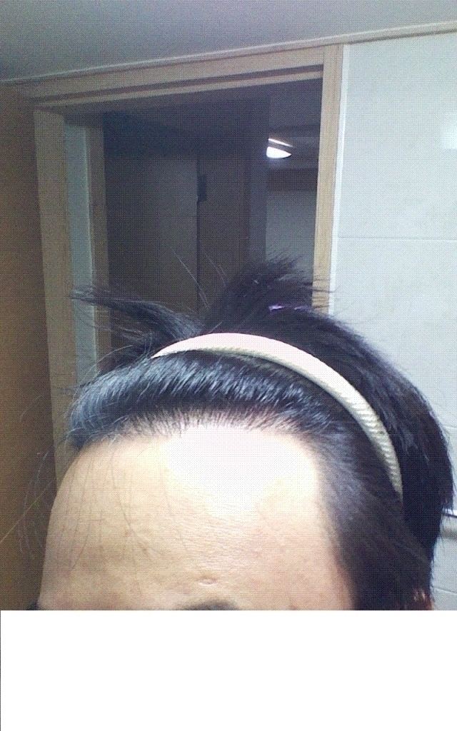 왼쪽.GIF