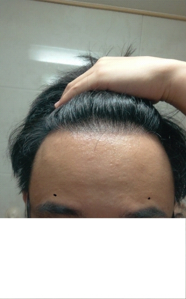 정면.GIF