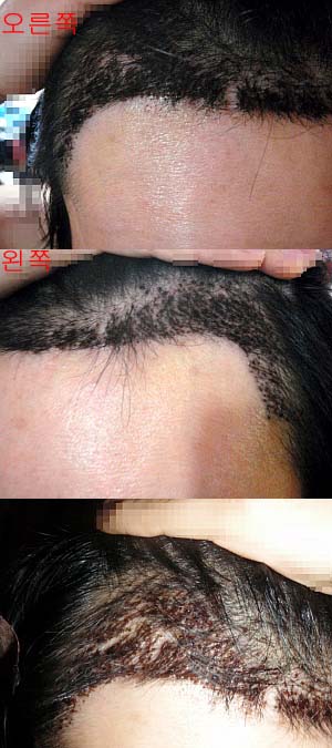 세부사진 일주일후 복사.jpg