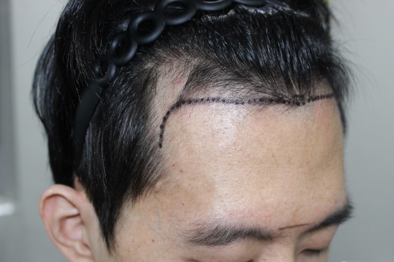 수술전2.jpg