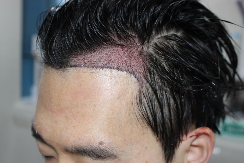 수술후1.jpg
