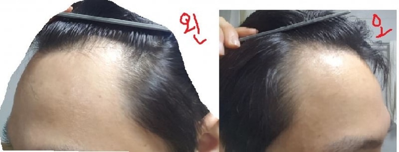 하기전.JPG