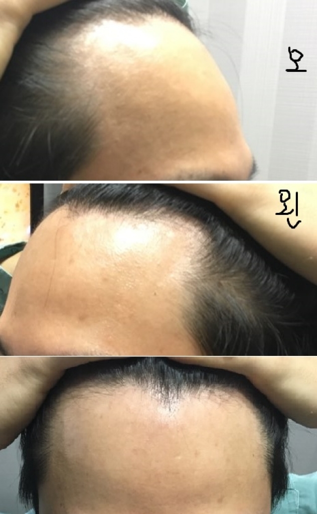 하기전모음.jpg