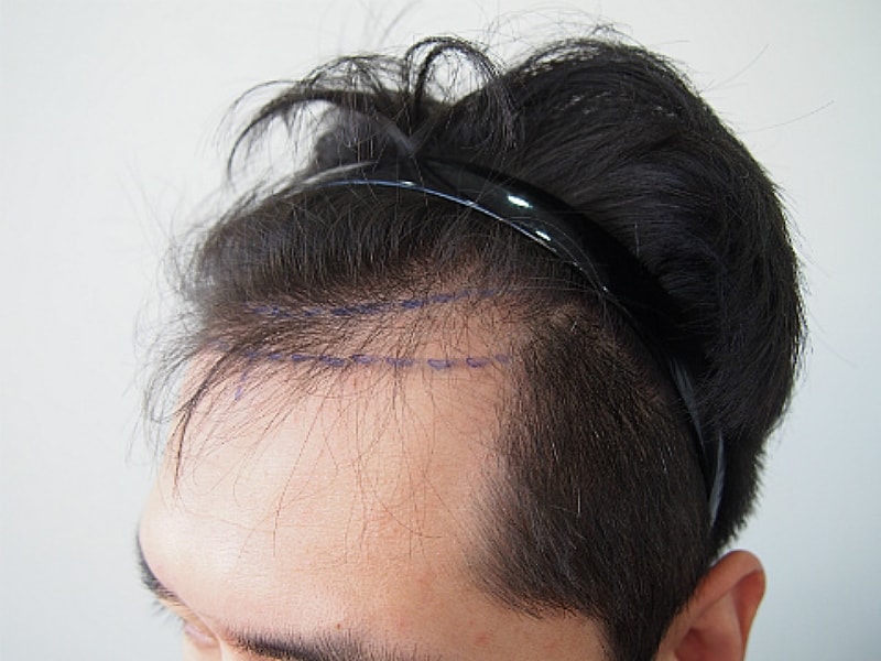 수술전4.jpg