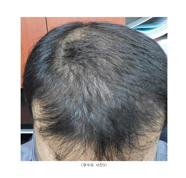정수리 사진3.jpg
