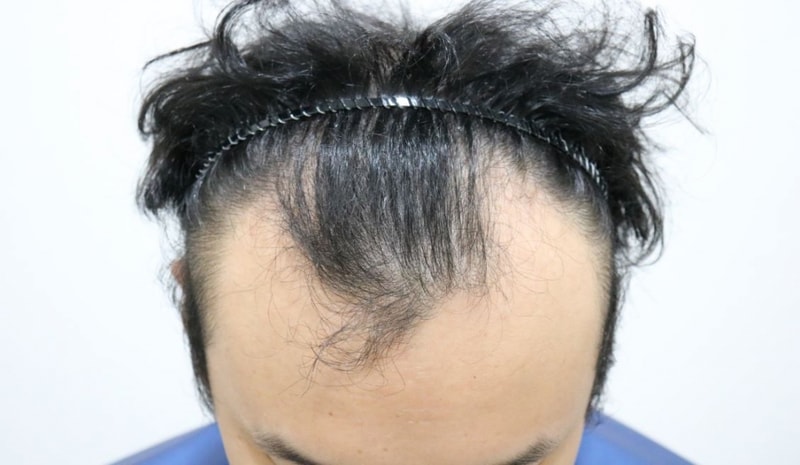 before.JPG