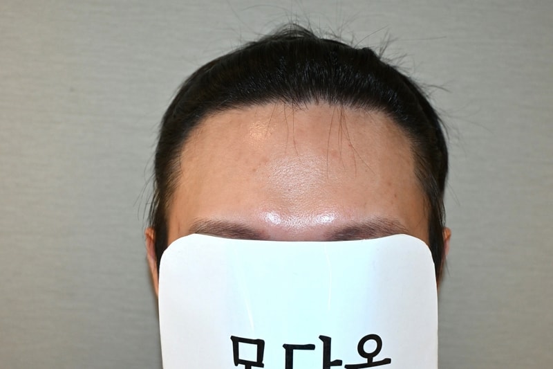 에프터.jpg