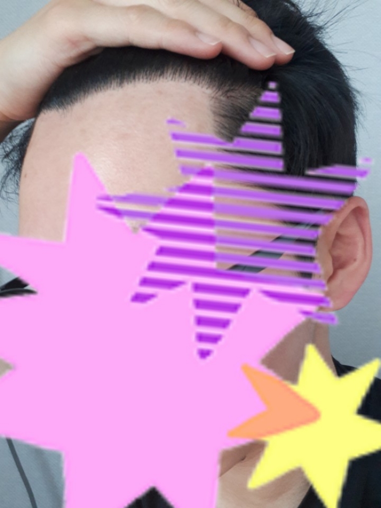 수술 8개월차 2.jpg