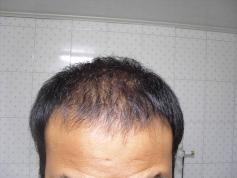 포맷변환_5개월.jpg