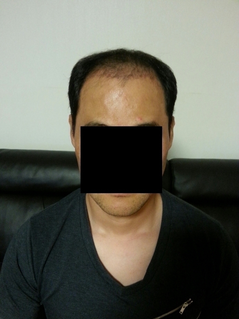 60일정면.jpg