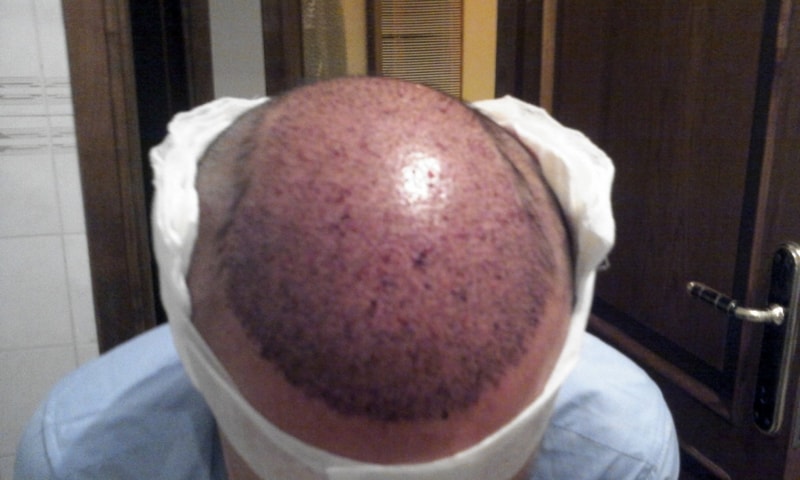 2011-11-16 18.18.16.jpg