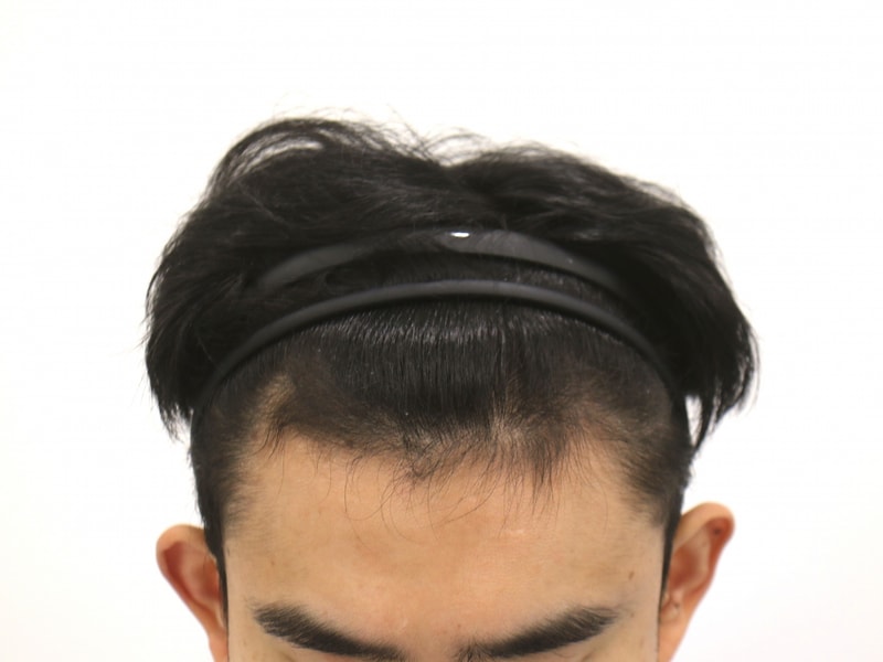 수술전.jpg