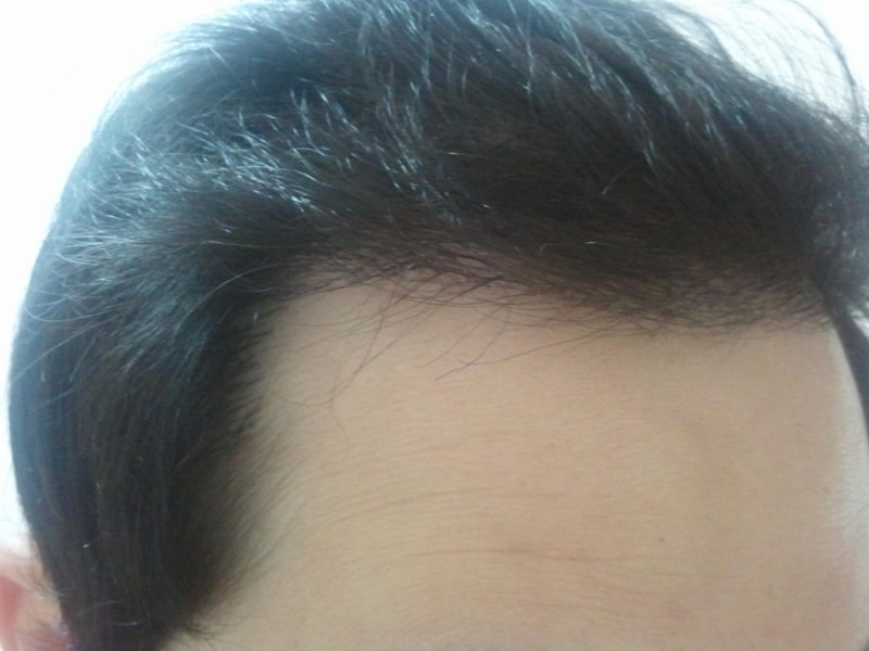 2011-11-13 18.25.30.jpg