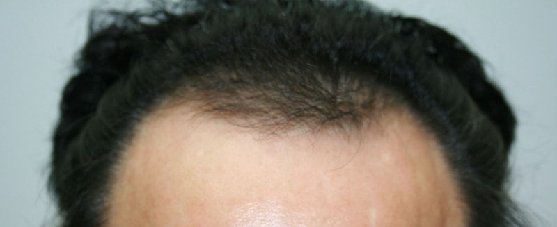 수술전사진.jpg