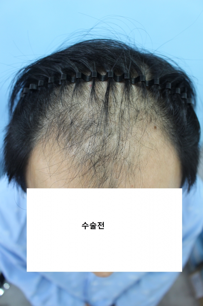 20181207조이삭 (11).JPG