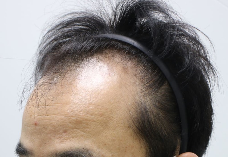 06.수술전.JPG
