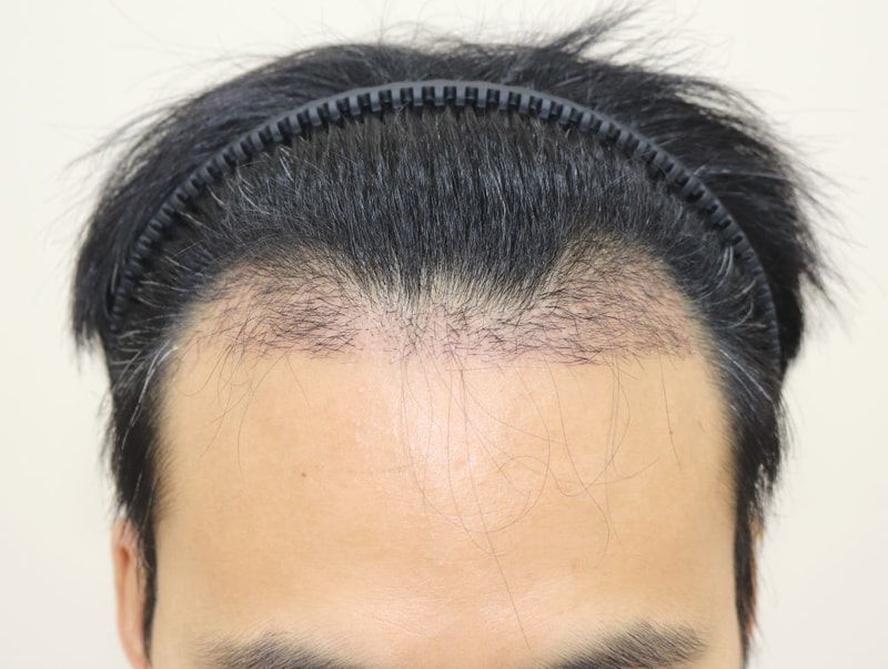 03.암흑기.JPG