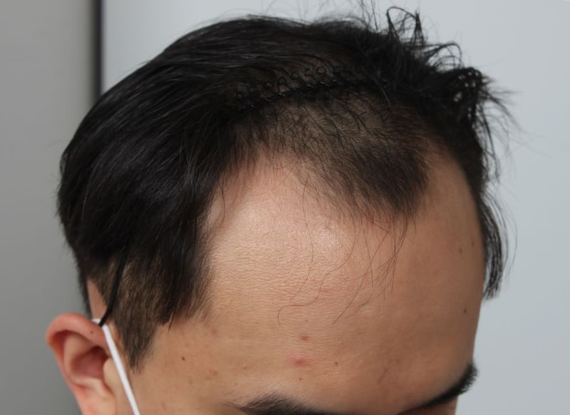 06.수술전.JPG