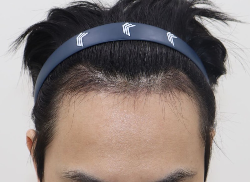 03.3개월차.JPG