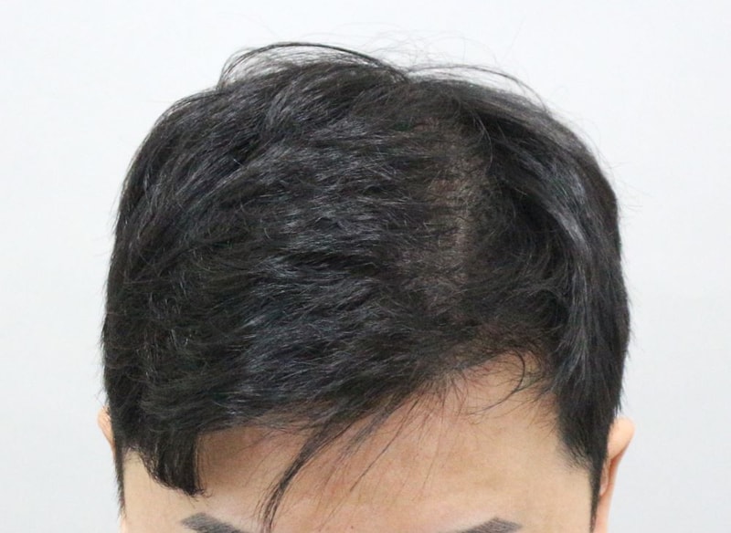 04.9달.JPG