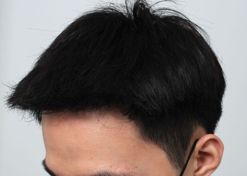 05.수술1년차.JPG