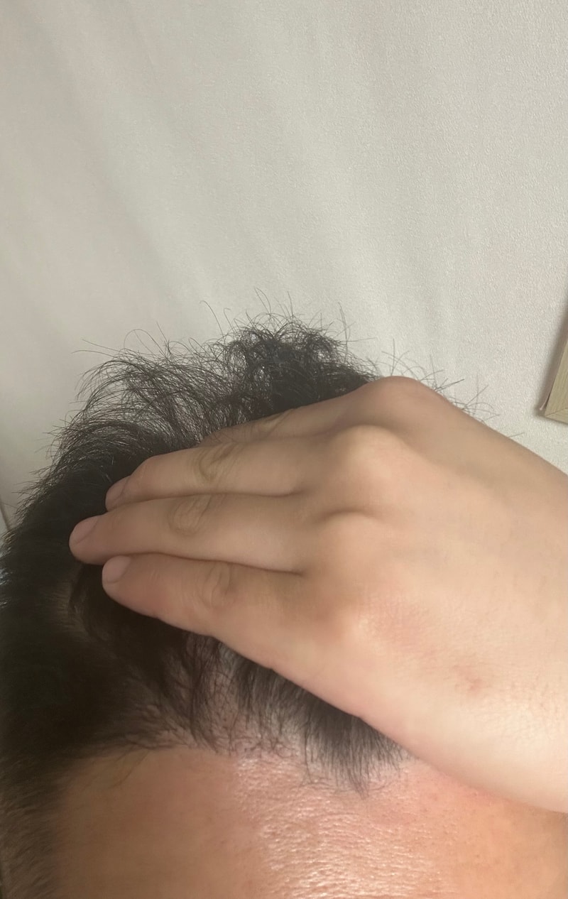 압구정 맘모스 150일차