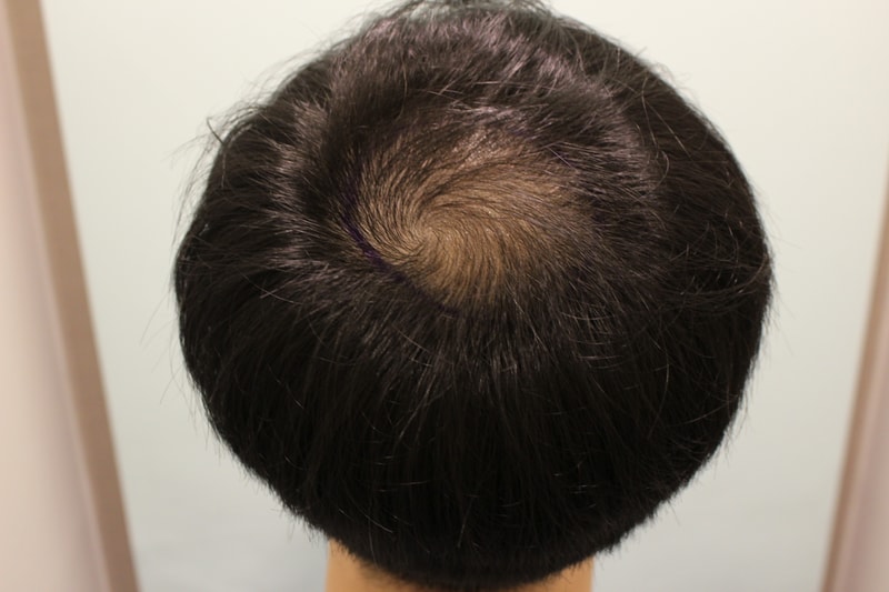 수술전디자인.JPG