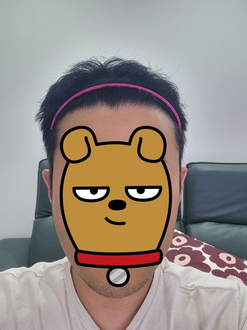 비절개 3600모 8개월차 후기 입니다