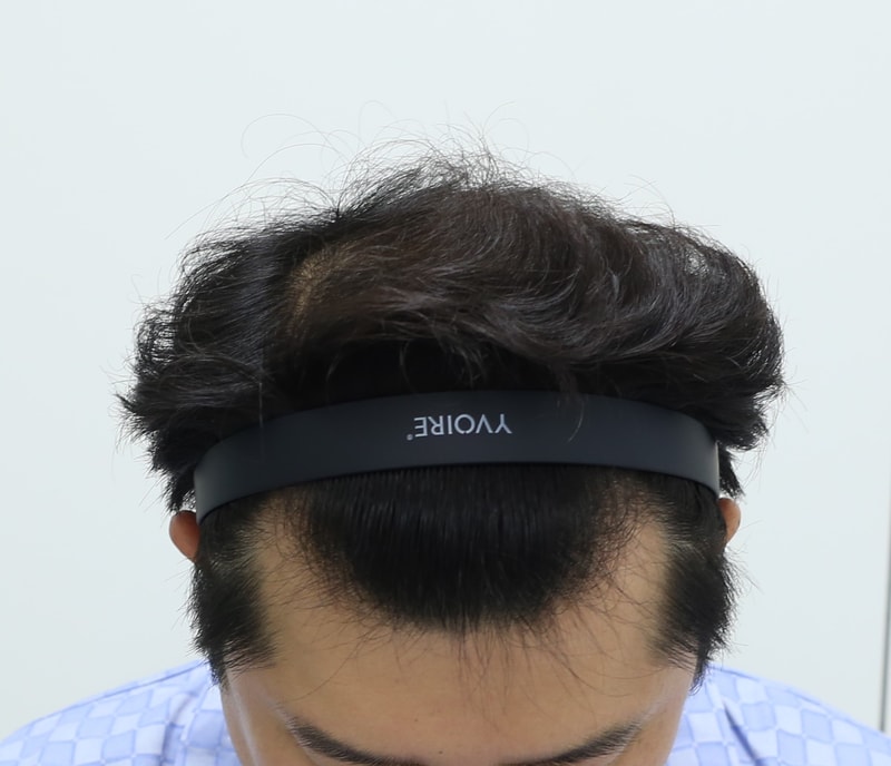 This is the review of the last 10 months and the total number of photos so far. Member for Apgujeong Mammoth Hairline.