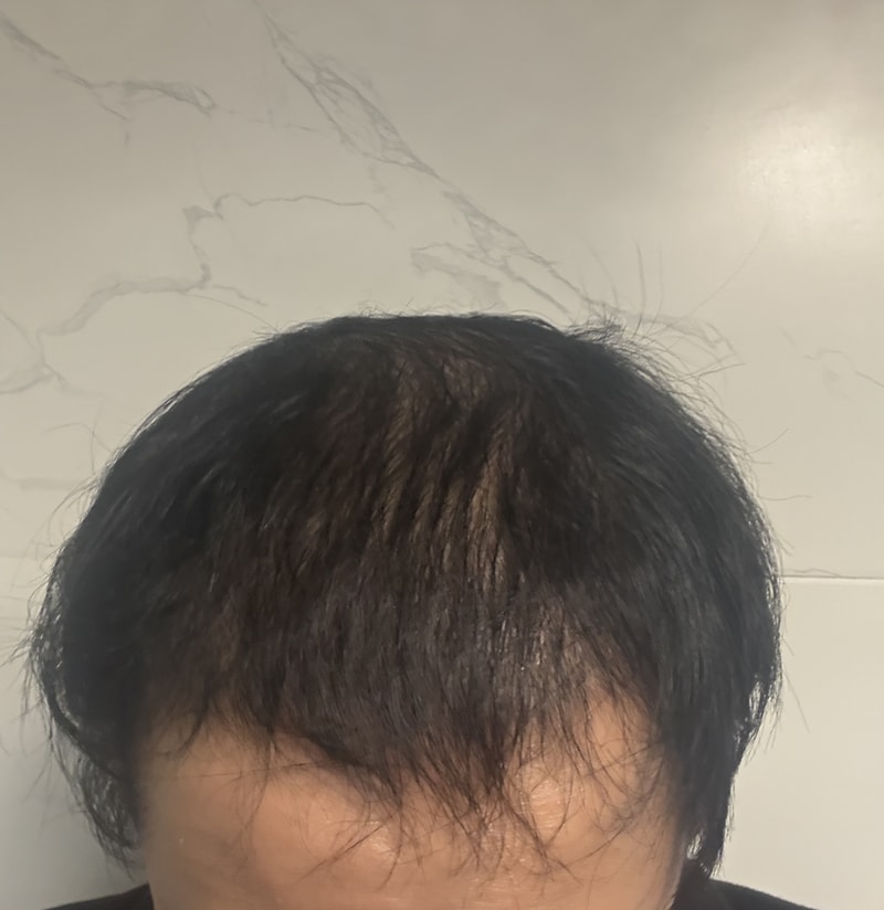 권남현 원장님의 헤이아치 소생기 세달차