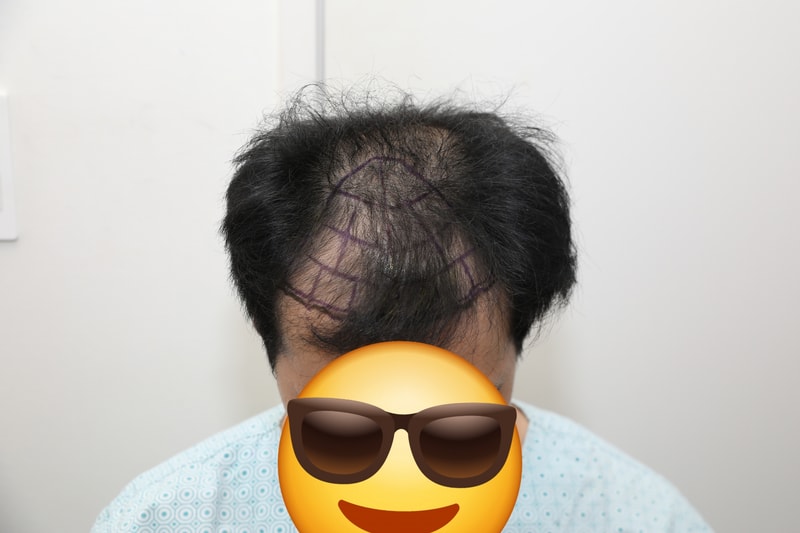 1000009089.jpg