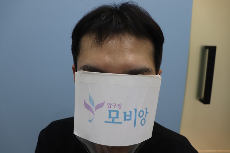 압구정모비앙 모발이식 1년차 후기