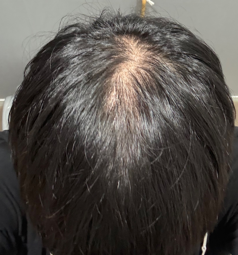 스크린샷 2025-06-11 113501.png