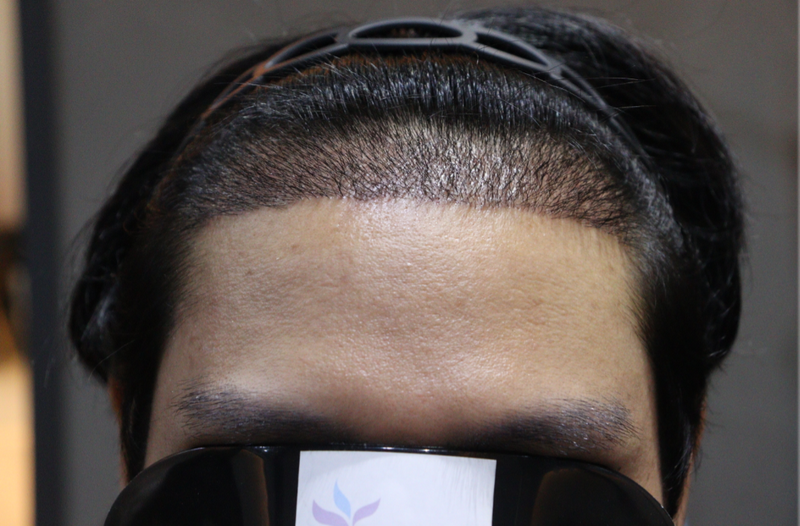 1000017626.png