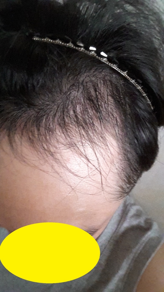 20150904_102207.jpg