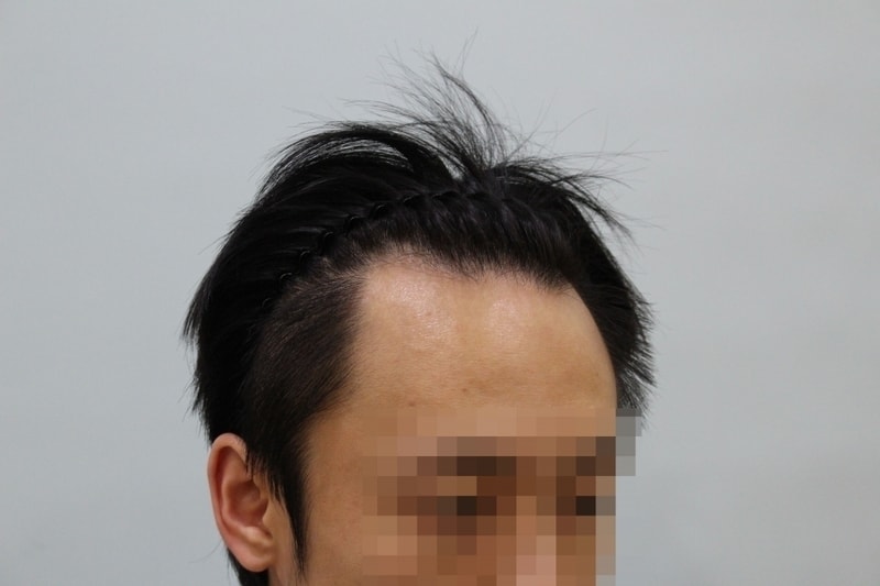 수술전 (4).JPG