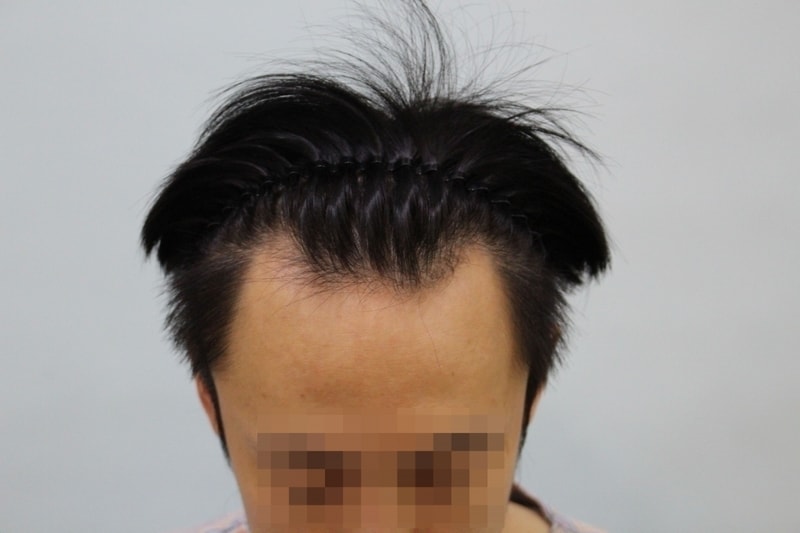 수술전 (7).JPG