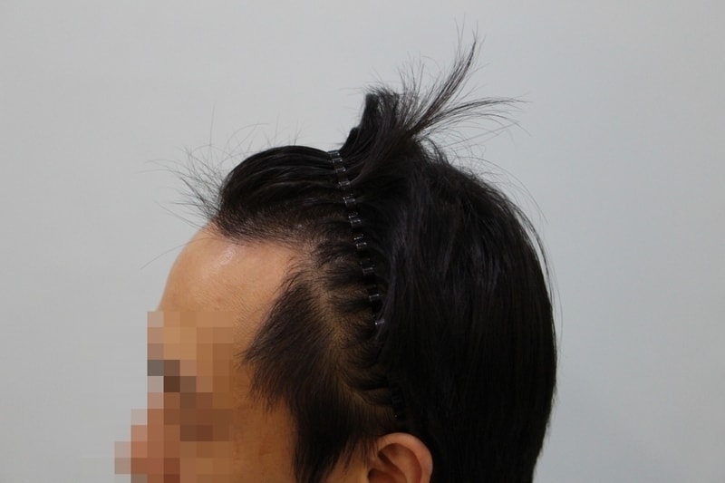 수술전 (1).JPG