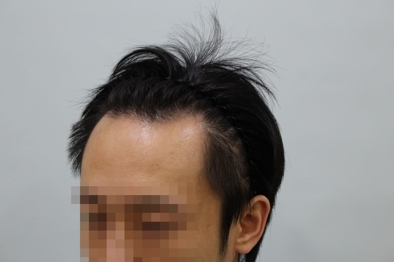수술전 (2).JPG