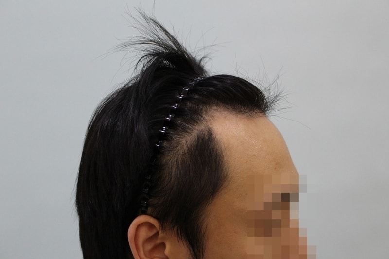 수술전 (3).JPG