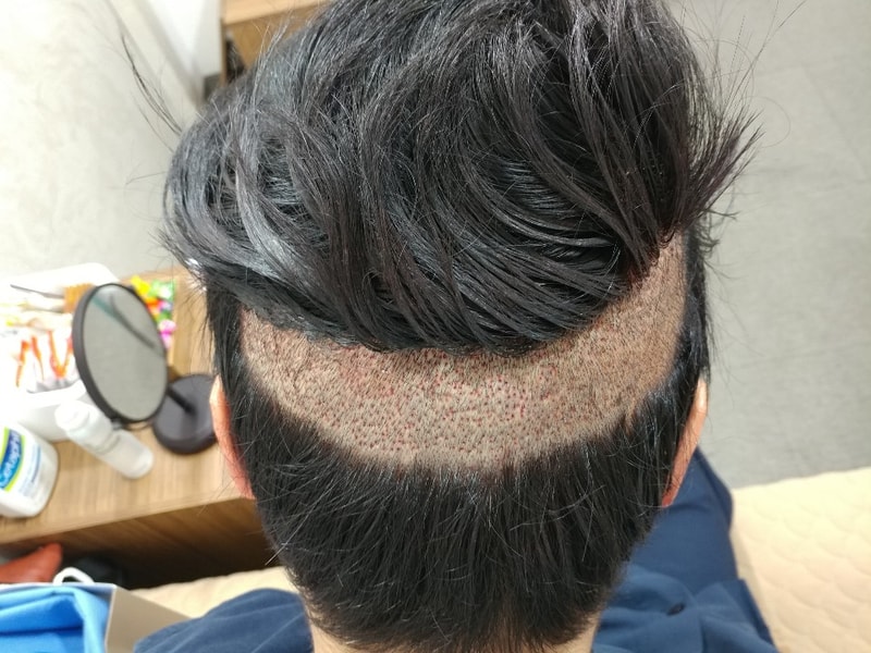채취부위.jpg