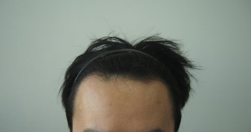 수술전.jpg