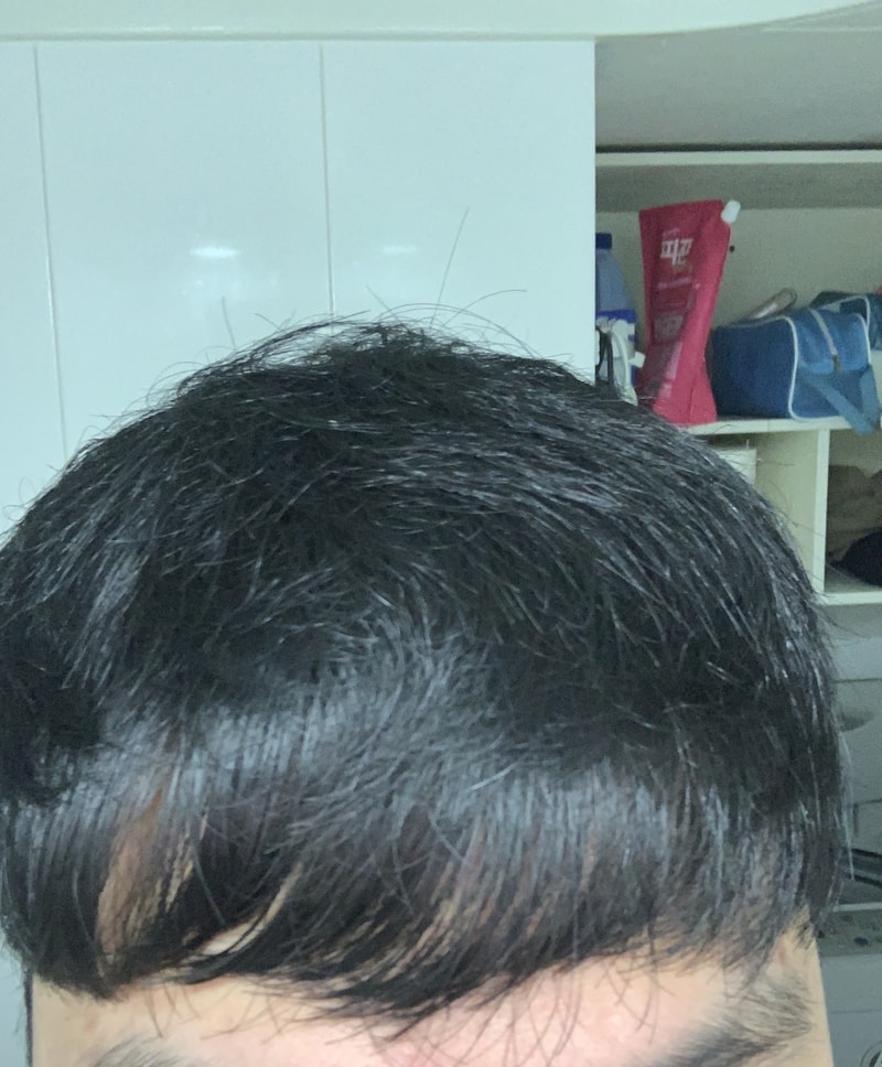앞머리내림.jpeg