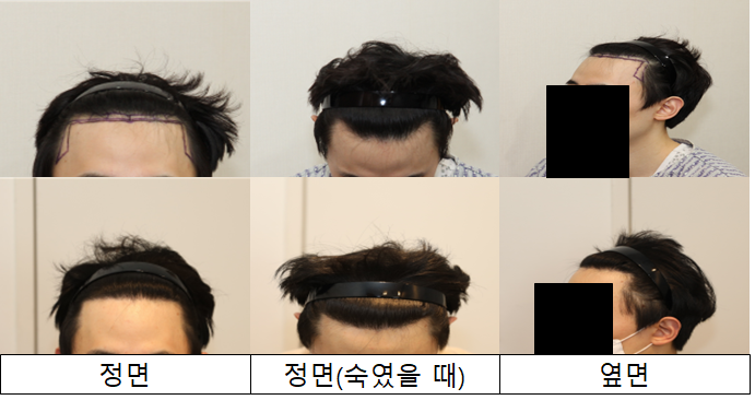 후기사진.png