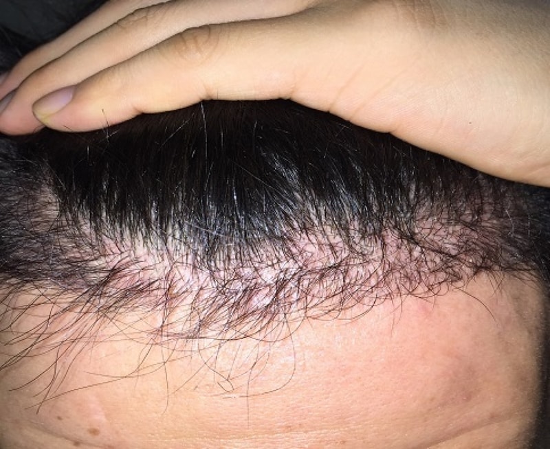 가운데 후4.jpg