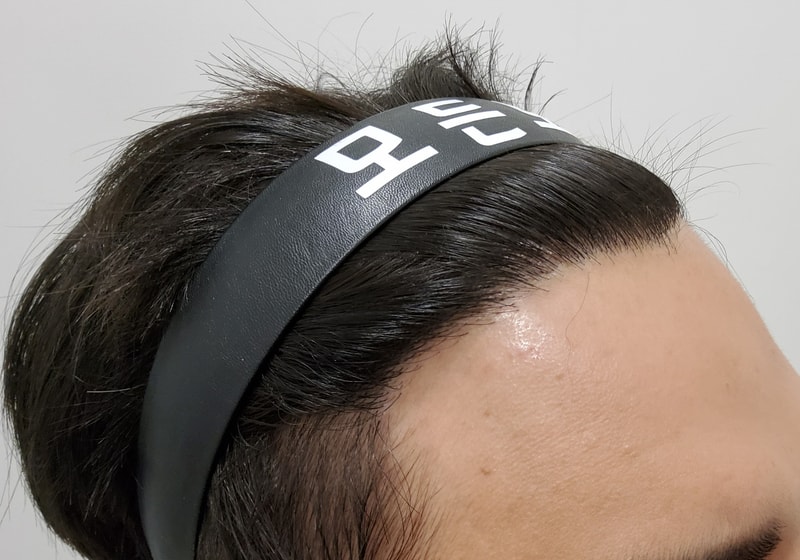 3. 수술후_1년_2.jpg