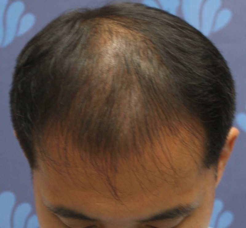 시술전2.JPG