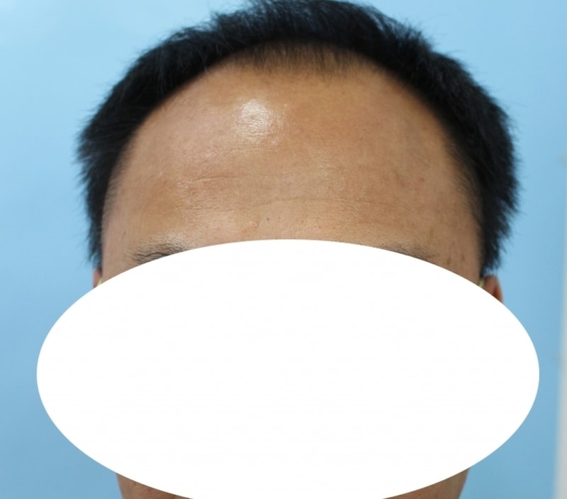 수술전 1.jpg