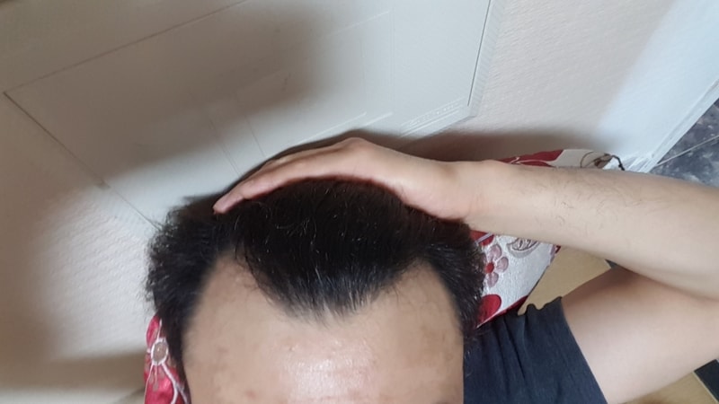 4일차 경과 입니다.