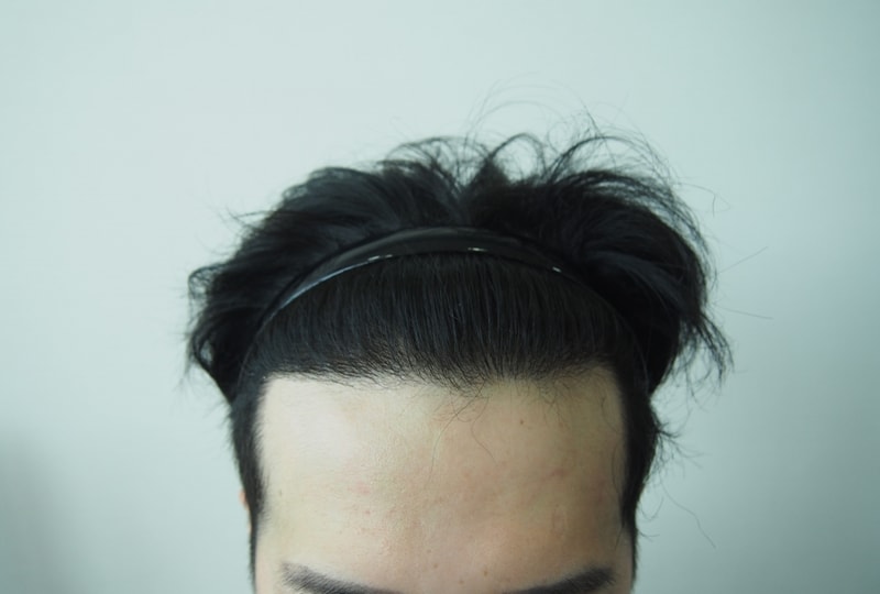 모재성 비절개 1년차